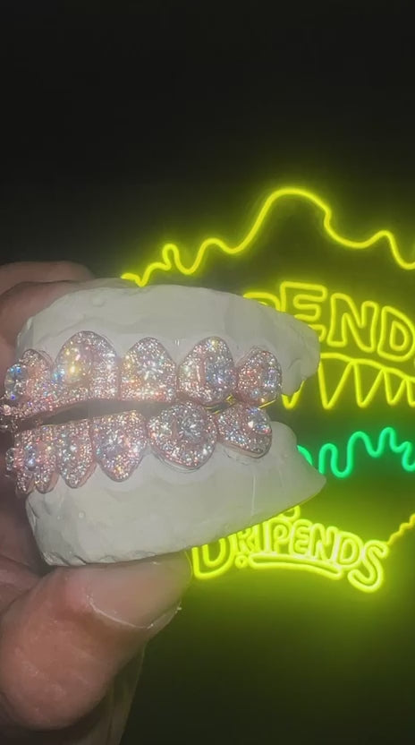 VVS Lab Diamond (CVD) Honeymoon Set Grillz